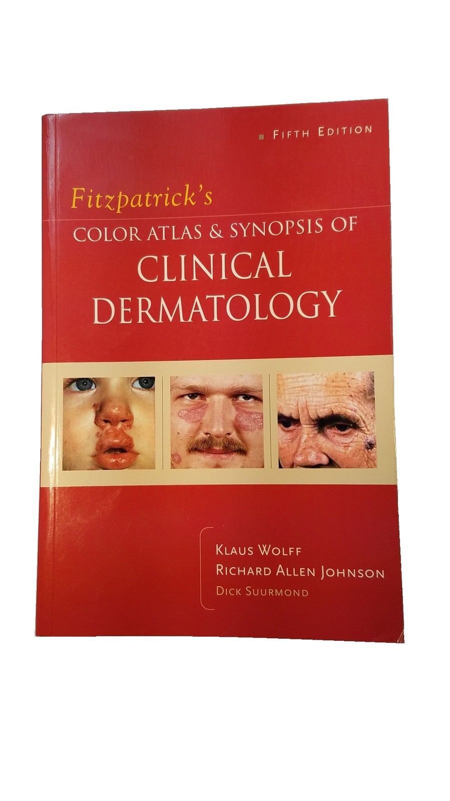 Fitzpatrick’s Color Atlas & Synopsis of Clinical Dermatology