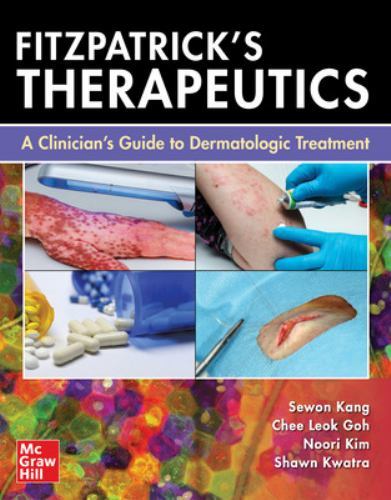 Fitzpatrick’s Therapeutics : A Clinician’s Guide to Dermatologic Treatment, P…
