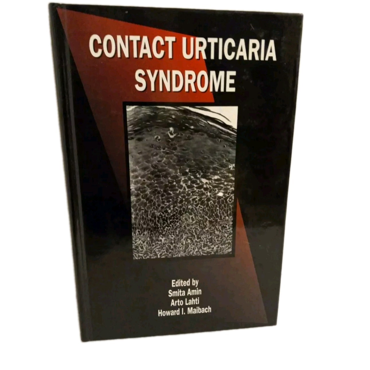 Contact Urticaria Syndrome (Dermatology: Clinical & Basic Science) 1997